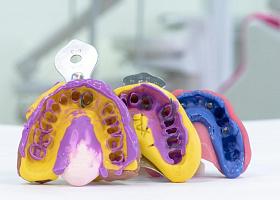 Силикон в ортопедической стоматологии